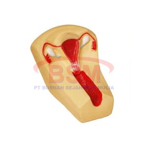 Phantom Manekin Uterus IUD LOKAL